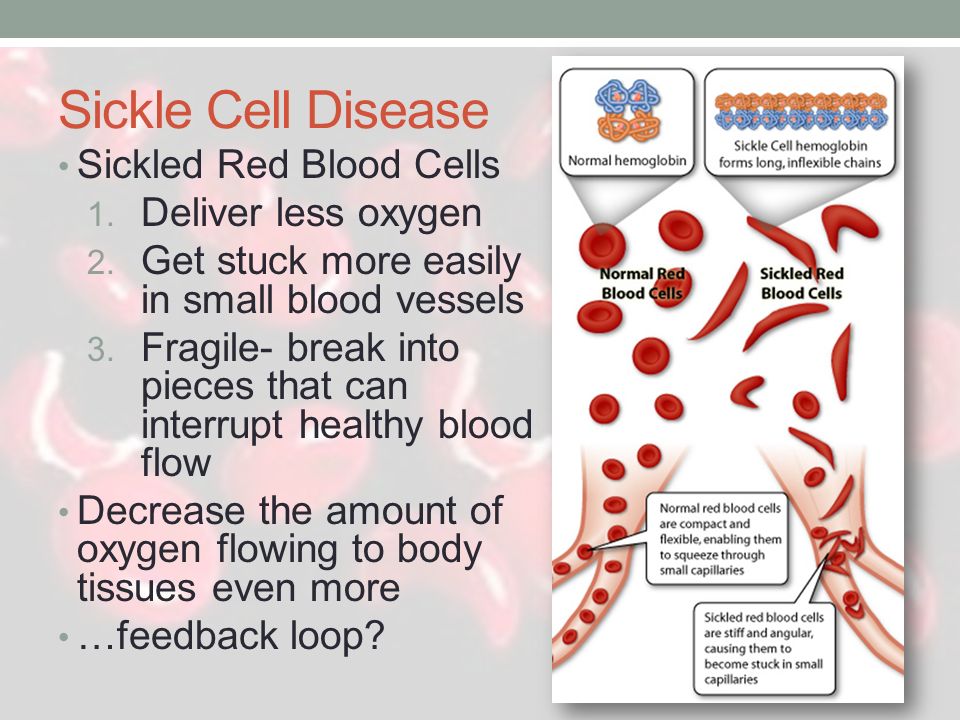 A report on sickle cell anemia causes and effects on the human body